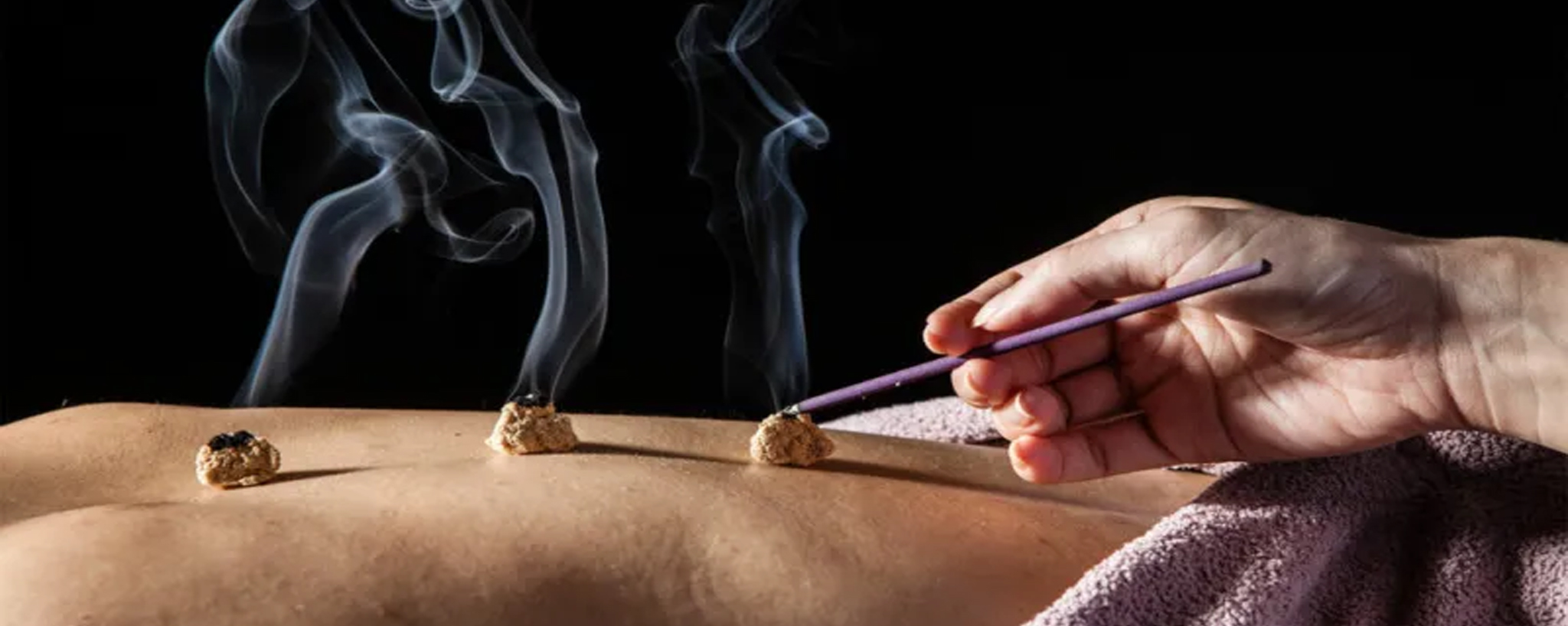 Châm cứu kinh điển